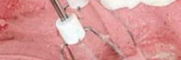 мусс клюквенный из манной крупы