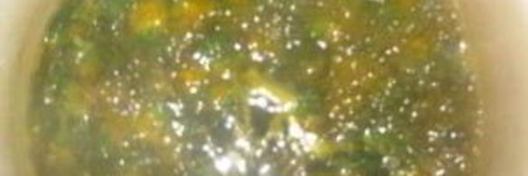 варенье из одуванчиков на фруктозе